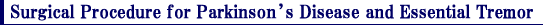 Surgical Procedure for Parkinsonfs Disease and Essential Tremor